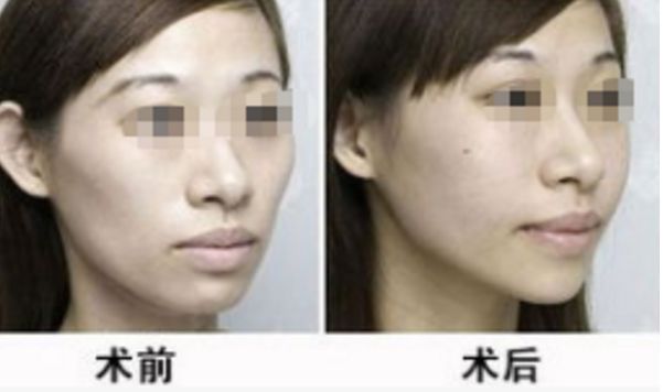 深圳眼袋抽脂手術(shù)醫(yī)院排名TOP10及消費(fèi)者評(píng)價(jià)