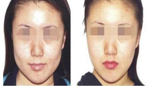 鄭州整形醫(yī)院口碑逐鹿：嘟嘟唇項目十強前哨摸底