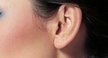 北京柏麗隆隆鼻效果如何