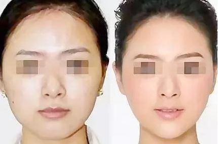 齊齊哈爾副乳切除效果好的醫(yī)院有哪些？盤點(diǎn)口腔醫(yī)院排行榜！