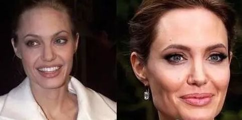 合肥眉間紋去除手術(shù)醫(yī)院性價(jià)比前十強(qiáng)推薦