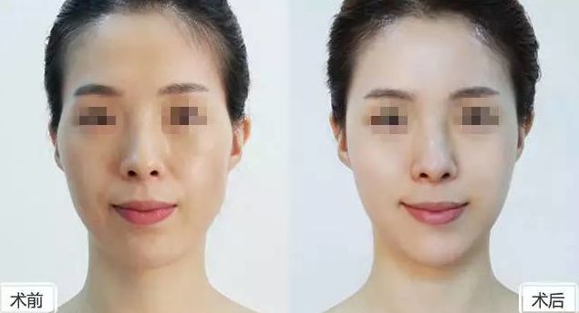 武漢整形醫(yī)院口碑實力榜：不容錯過的溶脂減肥領(lǐng)軍者