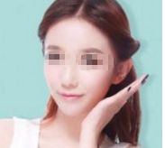 寧波眼周綜合美容醫(yī)院口碑排行揭秘