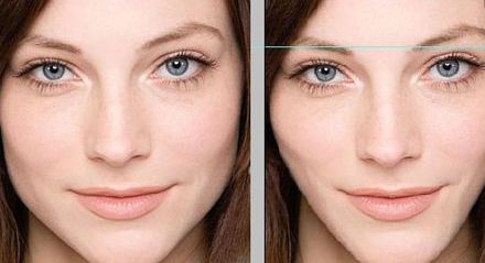 貴陽E光除皺好醫(yī)院，誰家口碑更棒？