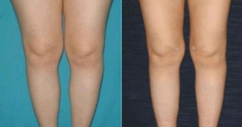 寶雞眼袋整形醫(yī)院大全：專業(yè)正規(guī)，解你的眼部煩惱