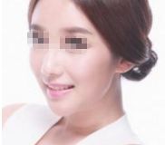 【推薦】眼睛細紋微整形美容醫(yī)院排名前十女生必看名單