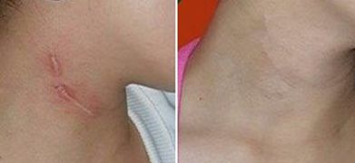 海南西部中心醫(yī)院院長(zhǎng)林喜風(fēng)簡(jiǎn)介