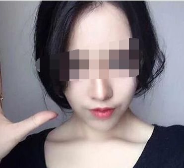 探尋福建小切口除疤痕紋醫(yī)院，權(quán)威榜單為你揭曉