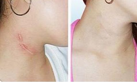 蘇州鼻綜合修復(fù)口碑前十排名，假期整形預(yù)約攻略