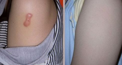 青島眼瞼修復(fù)名醫(yī)匯聚，哪家醫(yī)院實力更強(qiáng)？