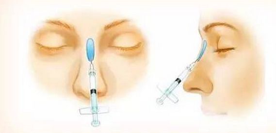 嘉興十大鼻部整形醫(yī)院推薦，手術(shù)縮鼻翼專家醫(yī)院排名揭秘