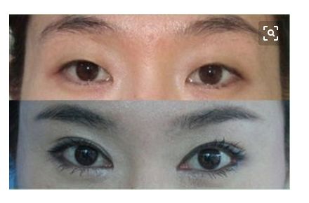 貴州哪些醫(yī)生值得信賴的隆鼻排名前三？