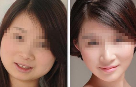 貴陽(yáng)麗都整形醫(yī)院隆鼻效果如何評(píng)價(jià)