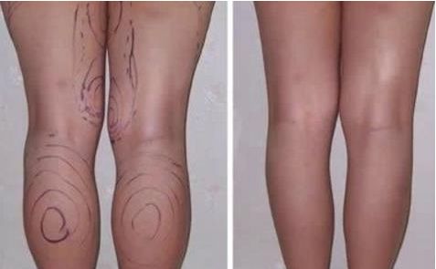 銀川痘印淡化最佳整形醫(yī)院排行榜TOP10，專家推薦【2024最新】