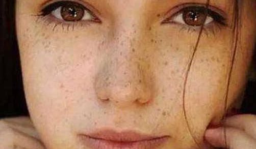 南通妊娠紋注射美容醫(yī)院排名推薦