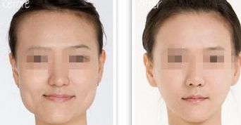 南昌哪家線雕醫(yī)院祛唇紋效果好？排行榜前十大醫(yī)療機(jī)構(gòu)揭秘