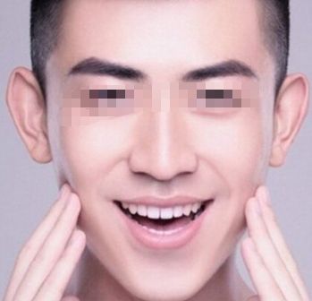 許昌哪家醫(yī)院祛雀斑口碑比較好？排名前10強醫(yī)療美容院揭秘！