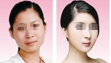 長(zhǎng)春下巴疤痕修復(fù)醫(yī)療整形排行榜Top10實(shí)測(cè)匯總