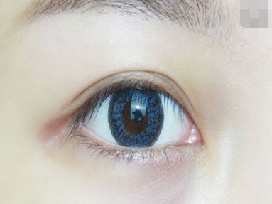 長沙眼部皺紋整形醫(yī)院排行榜及口碑測評