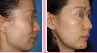 沈陽眼瞼懸吊術(shù)，哪家醫(yī)院口碑好？看看這十佳榜單