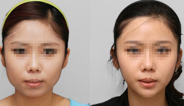 哈爾濱去毛孔好口碑醫(yī)院大揭秘！前十實力榜單不容錯過