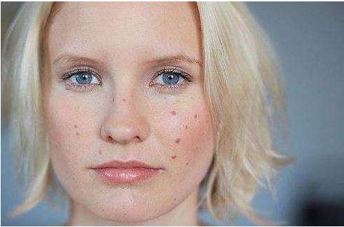 長沙面部填充手術(shù)哪家醫(yī)院好？十大整形醫(yī)院綜合排名大揭秘