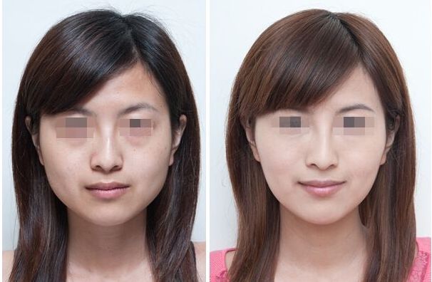 北京瘦腰美容醫(yī)院權(quán)威榜單，為你揭曉美體塑形圣地！