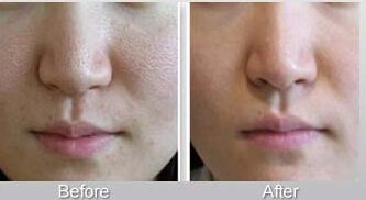 北京整形美容醫(yī)院推薦排行榜大揭秘！