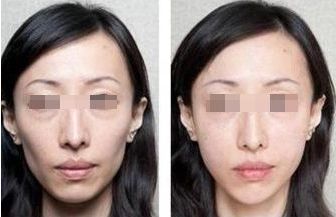 貴陽揚(yáng)名小腿吸脂口碑佳！10家正規(guī)醫(yī)院榜單速覽