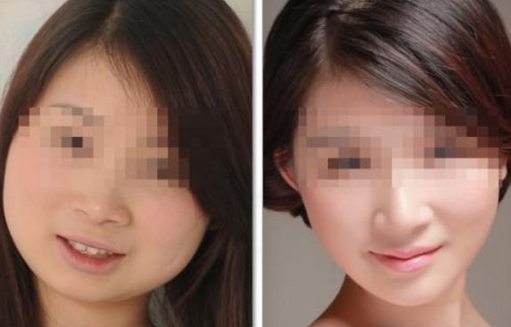 北京隆胸整容醫(yī)院哪家好？