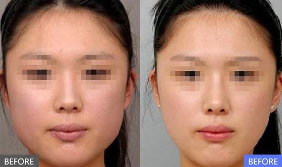 南充受歡迎的十佳膠原蛋白祛除妊娠紋整形醫(yī)院推薦