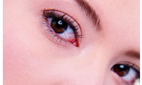 泰國Apex醫(yī)療中心與曼谷F CLINIC：硅膠豐下巴親身體驗(yàn)全解析