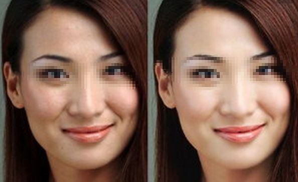 濟(jì)寧眼角紋嗨體填充醫(yī)院前十排行