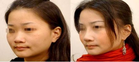 廈門哪家醫(yī)院做隆胸好？醫(yī)院排名前十！名單及技術(shù)特色詳解！點擊查看