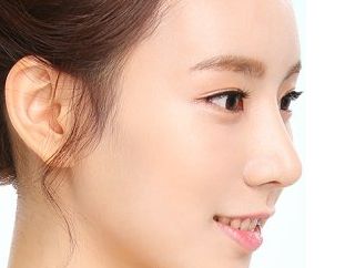 常州施爾美隆胸手術(shù)效果評(píng)價(jià)如何？