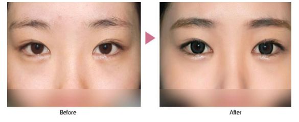 武漢五維祛痘醫(yī)院口碑實(shí)力大盤點(diǎn)，助你輕松祛痘煥新顔