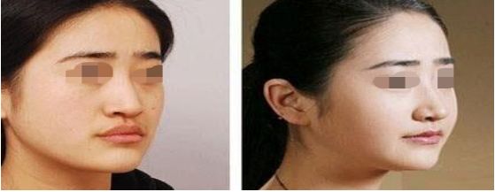 孝感激光爆破美容醫(yī)院排名前十精選榜單