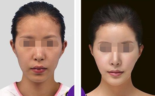 【2024年最新】濟(jì)寧?kù)疃磺笆蚊廊葆t(yī)院排行榜大揭秘！