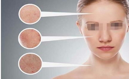 長沙祛除眶下皺紋推薦：10家信譽卓著的整形醫(yī)院