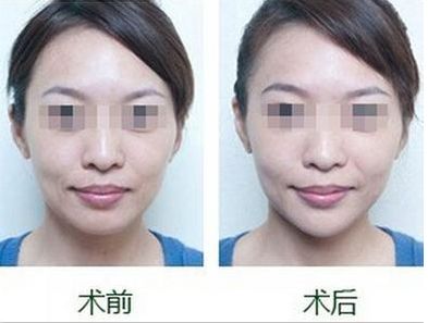 陜西小腿脫毛醫(yī)院口碑推薦前十位