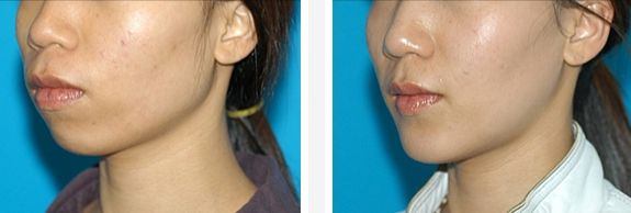 烏魯木齊最佳激光射頻緊縮整形醫(yī)院排名TOP10