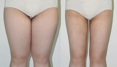 濟(jì)南印第安紋玻尿酸填充十佳權(quán)威整形醫(yī)院盤(pán)點(diǎn)