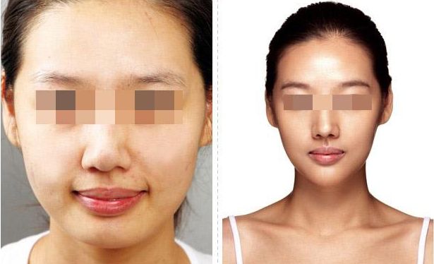 洛陽眼周細(xì)紋去除，十家整形醫(yī)院評(píng)測(cè)