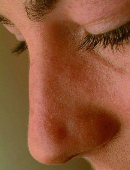 上海各正畸美容醫(yī)院口碑指南：下巴后縮矯正專業(yè)機(jī)構(gòu)大比拼