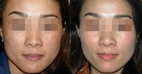 南昌口碑鼻整形醫(yī)院TOP10強勢盤點！