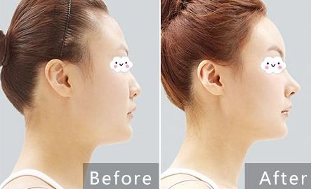 遵義除腋臭十佳美容醫(yī)院推薦