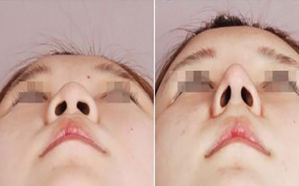 寧波botox除皺綜合實(shí)力TOP10整形美容機(jī)構(gòu)盤點(diǎn)