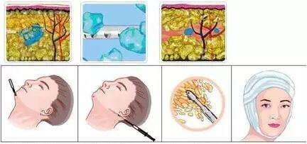 上海私密修復(fù)醫(yī)院排行榜 公立前10強名單揭曉！九院持續(xù)亮眼