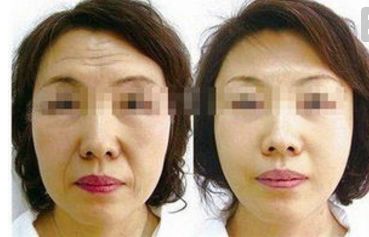 貴陽比較好的隆胸醫(yī)院推薦！