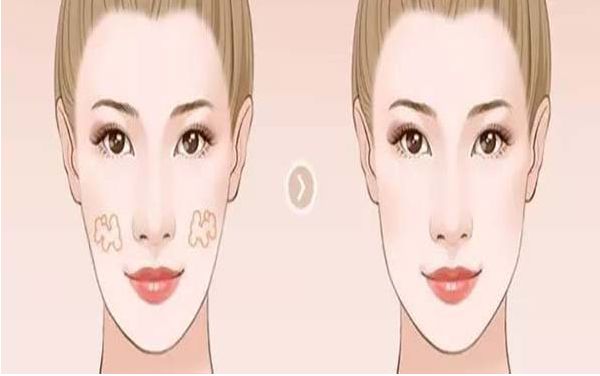 煙臺靜態(tài)紋去除醫(yī)療機(jī)構(gòu)推薦排行榜TOP10，專家齊聚解讀！